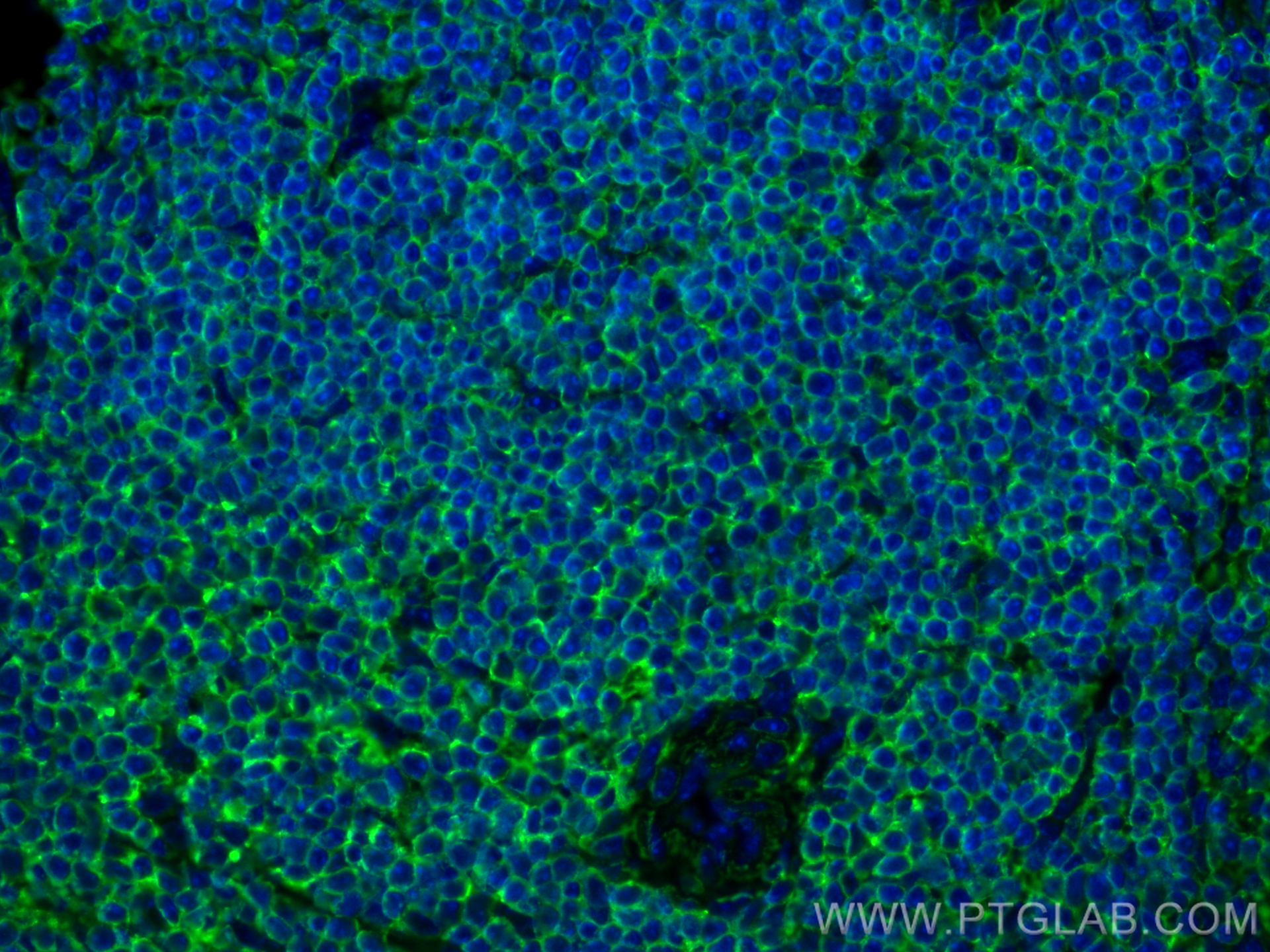 Immunofluorescence (IF) / fluorescent staining of mouse spleen tissue using TIGIT Recombinant antibody (83545-1-RR)