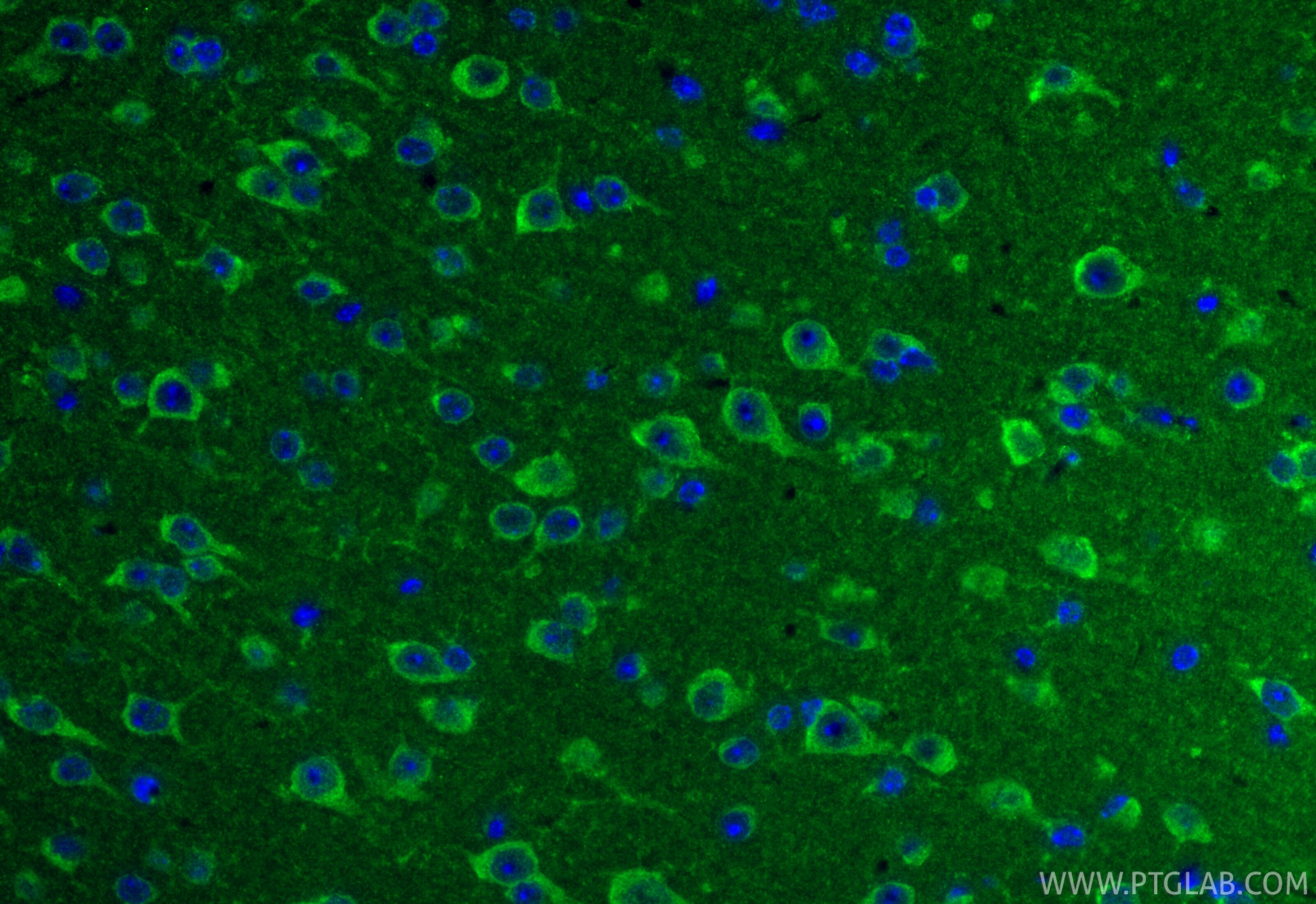 Immunofluorescence (IF) / fluorescent staining of mouse brain tissue using TIMM17A Polyclonal antibody (11189-1-AP)