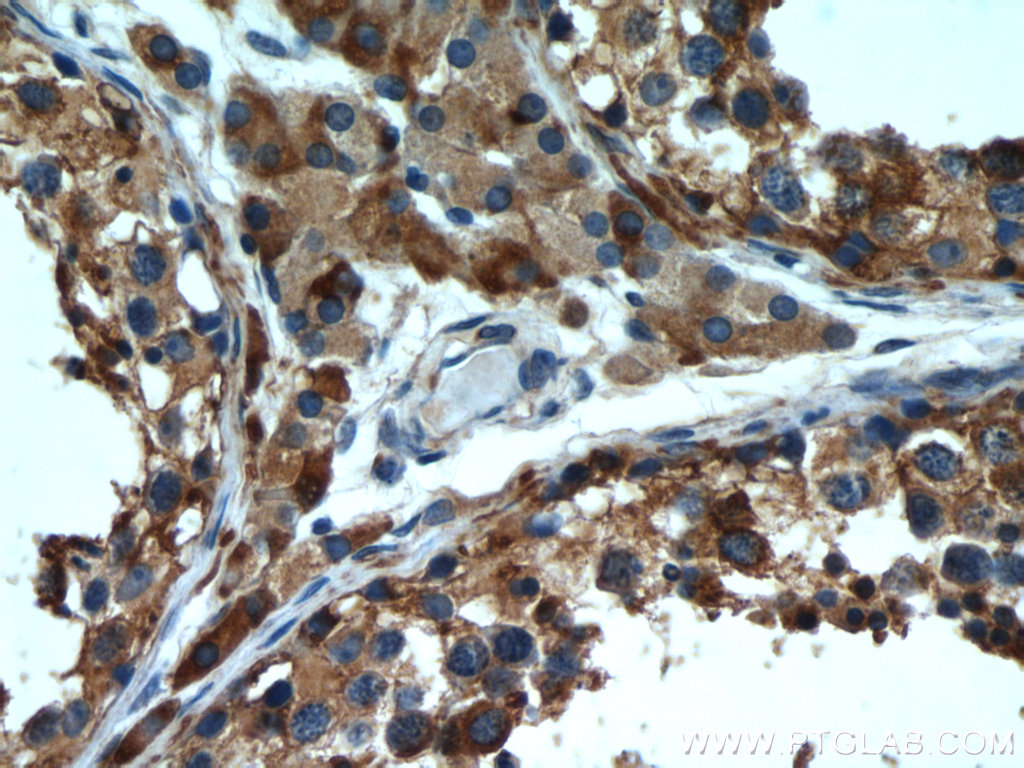 Immunohistochemistry (IHC) staining of human testis tissue using Tim23 Polyclonal antibody (11123-1-AP)