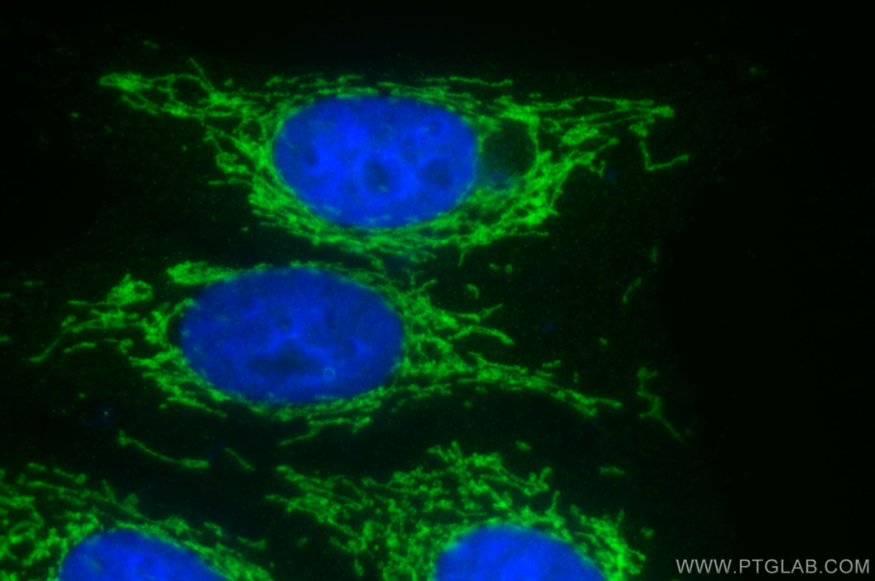 Immunofluorescence (IF) / fluorescent staining of HepG2 cells using TIMM44 Polyclonal antibody (13859-1-AP)