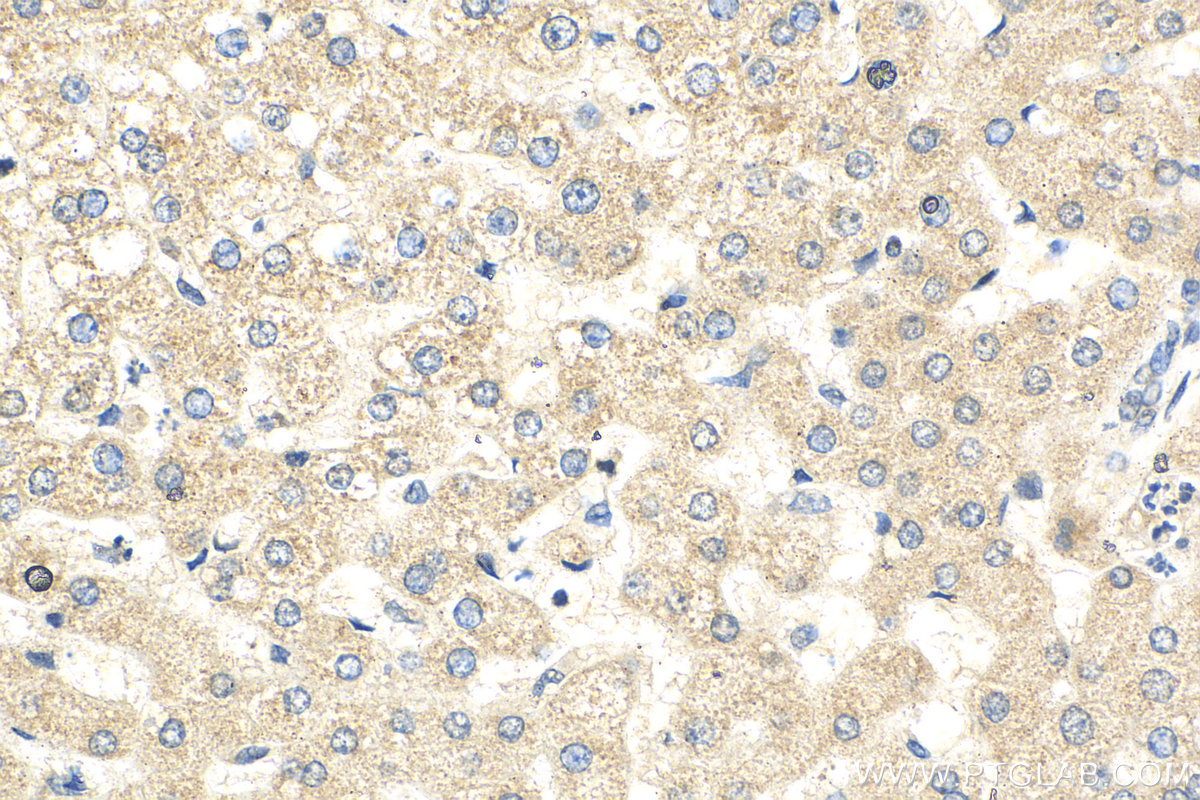 Immunohistochemistry (IHC) staining of human liver tissue using TIMM44 Polyclonal antibody (13859-1-AP)