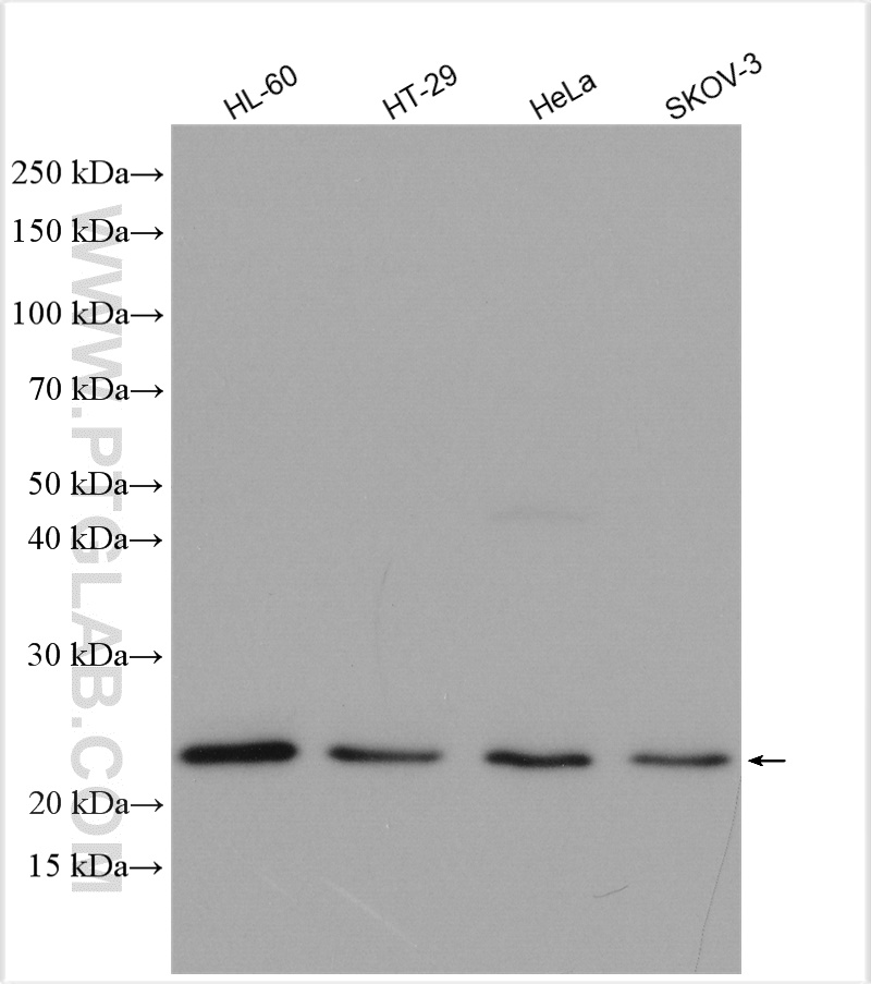 Western Blot (WB) analysis of various lysates using TIMP1 Polyclonal antibody (16644-1-AP)