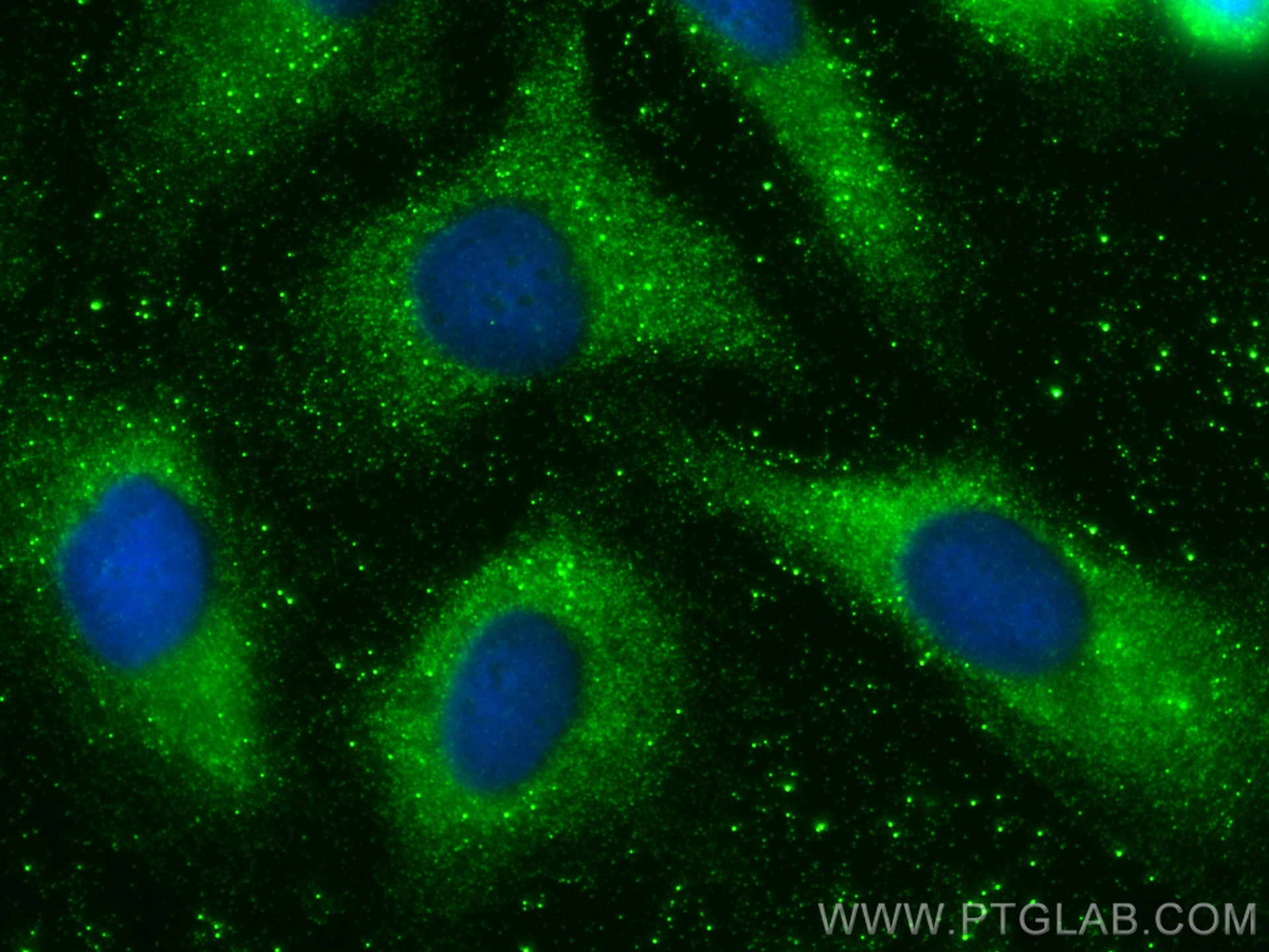 Immunofluorescence (IF) / fluorescent staining of SKOV-3 cells using TIMP1 Polyclonal antibody (26847-1-AP)