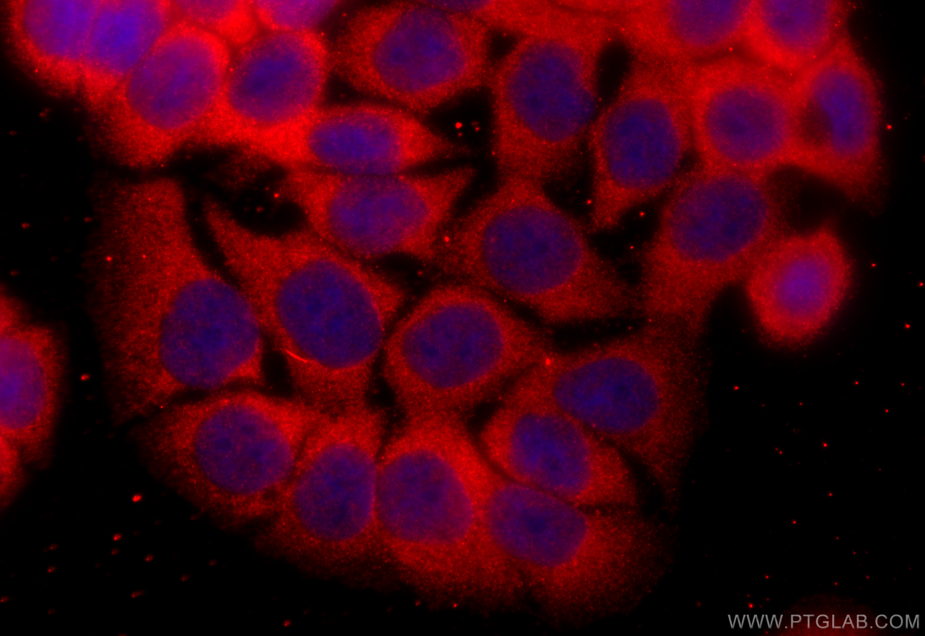 Immunofluorescence (IF) / fluorescent staining of HT-29 cells using TIMP1 Polyclonal antibody (26847-1-AP)