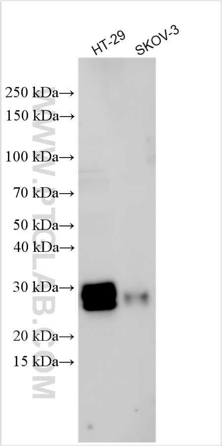 Western Blot (WB) analysis of various lysates using TIMP1 Polyclonal antibody (26847-1-AP)