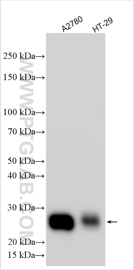 Western Blot (WB) analysis of various lysates using TIMP1 Polyclonal antibody (30755-1-AP)