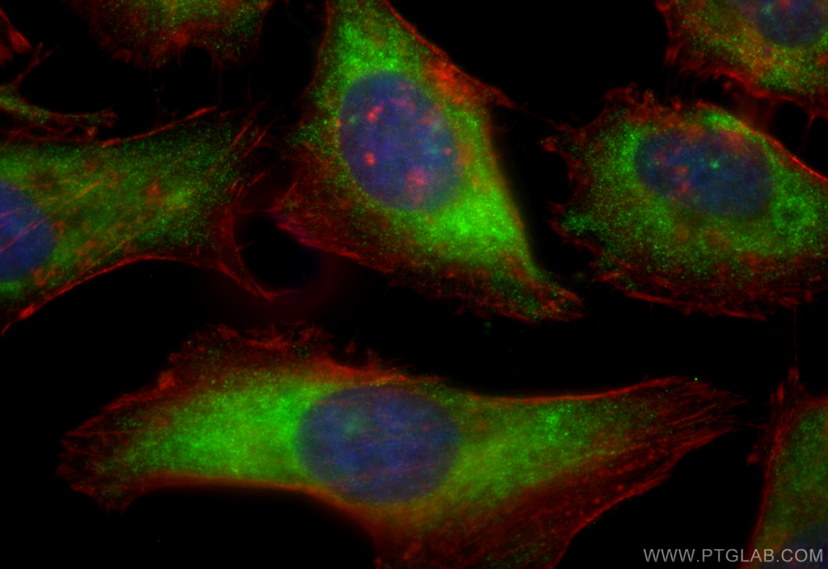 Immunofluorescence (IF) / fluorescent staining of HeLa cells using CoraLite® Plus 488-conjugated TIMP1 Recombinant an (CL488-83151-5)