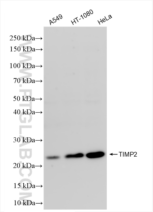 Western Blot (WB) analysis of various lysates using TIMP2 Recombinant antibody (83938-3-RR)