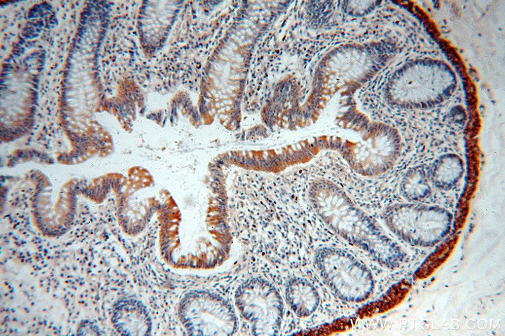 Immunohistochemistry (IHC) staining of human colon tissue using TINAG-Specific Polyclonal antibody (19747-1-AP)