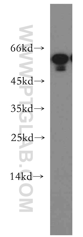 Western Blot (WB) analysis of mouse small intestine tissue using TINAG-Specific Polyclonal antibody (19747-1-AP)