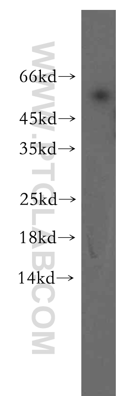 Western Blot (WB) analysis of human kidney tissue using TINAG-Specific Polyclonal antibody (19747-1-AP)