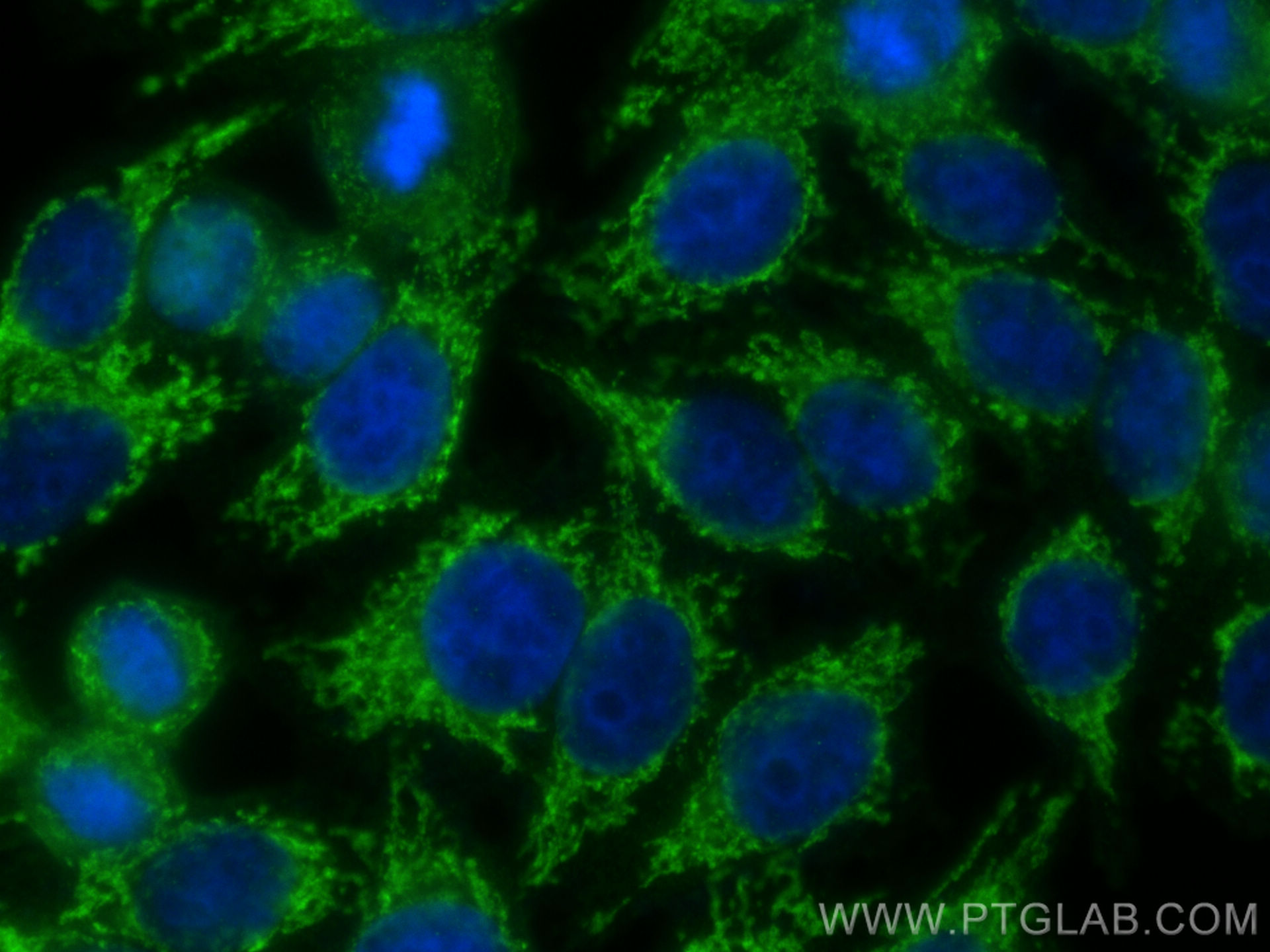 Immunofluorescence (IF) / fluorescent staining of HepG2 cells using TINAGL1 Polyclonal antibody (12077-1-AP)