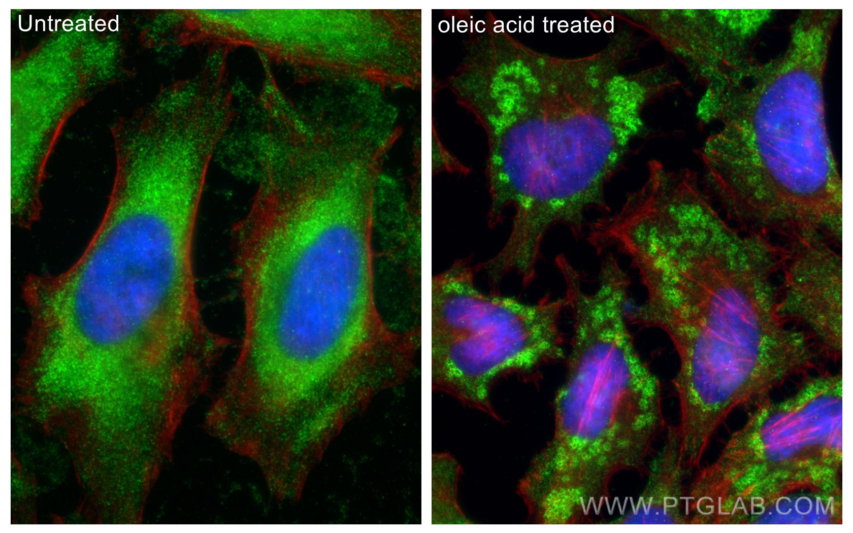 Immunofluorescence (IF) / fluorescent staining of HeLa cells using Perilipin 3/TIP47 Monoclonal antibody (66523-1-Ig)