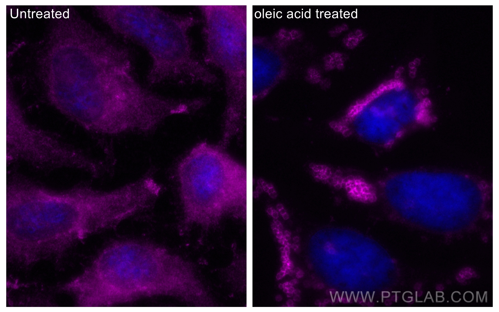 Immunofluorescence (IF) / fluorescent staining of HeLa cells using CoraLite® Plus 647-conjugated TIP47 Polyclonal ant (CL647-10694)