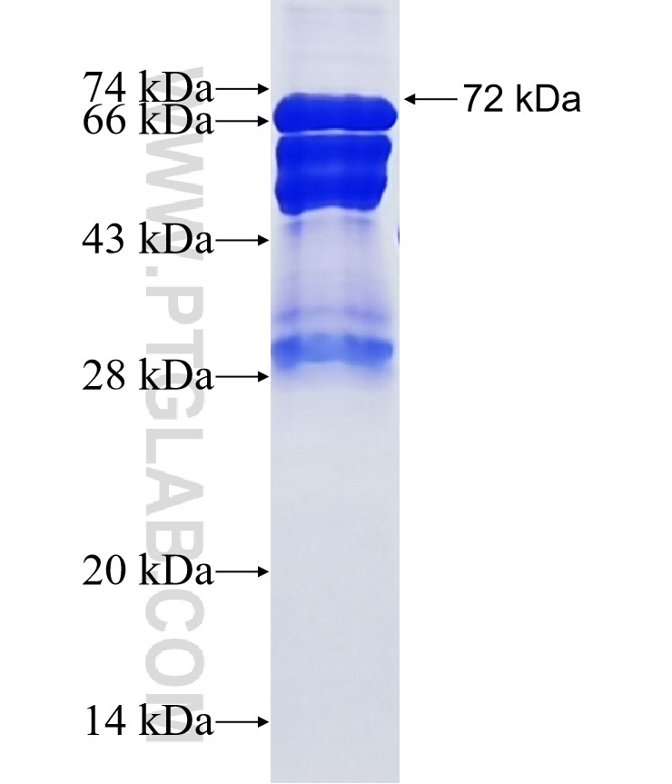 TJAP1 fusion protein Ag12174 SDS-PAGE