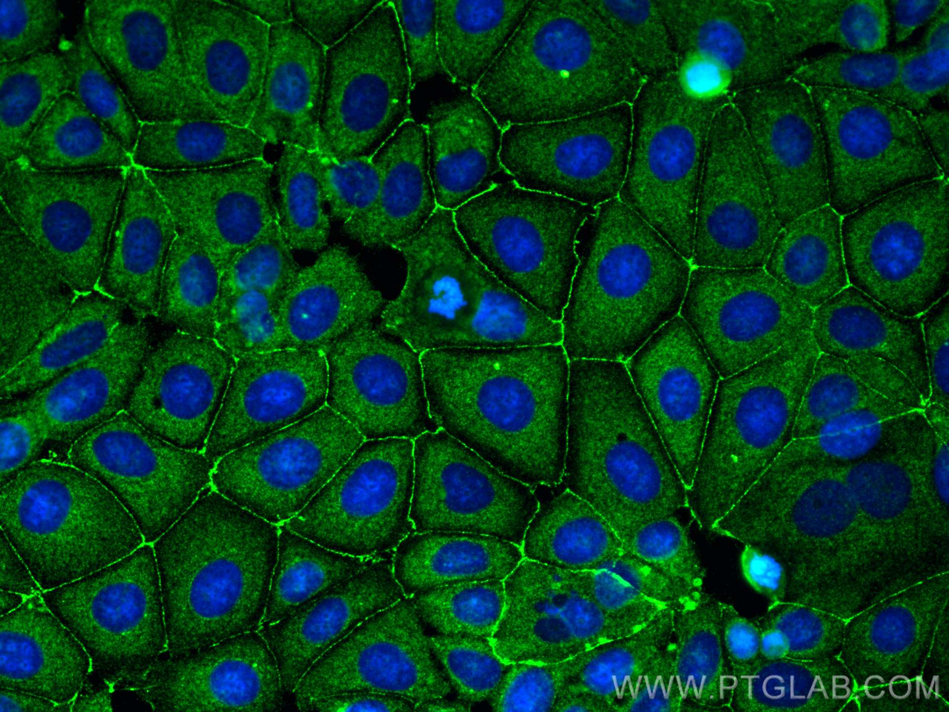 Immunofluorescence (IF) / fluorescent staining of MCF-7 cells using ZO-2 Polyclonal antibody (18900-1-AP)