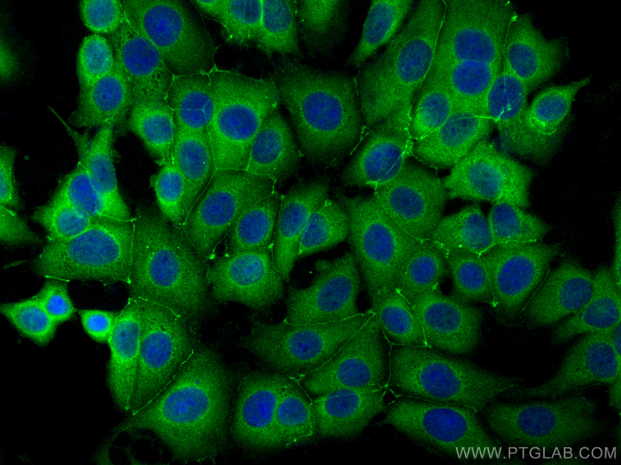 Immunofluorescence (IF) / fluorescent staining of MCF-7 cells using ZO-2 Polyclonal antibody (18900-1-AP)