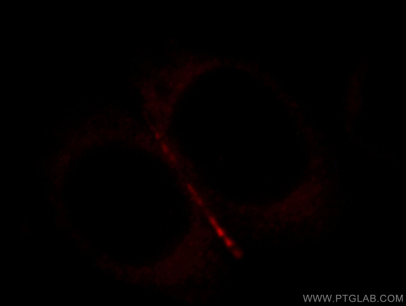 Immunofluorescence (IF) / fluorescent staining of MCF-7 cells using ZO-2 Polyclonal antibody (18900-1-AP)