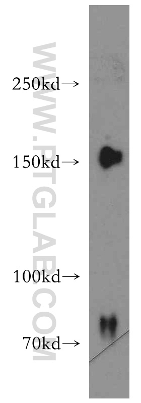 Western Blot (WB) analysis of MCF-7 cells using ZO-2 Polyclonal antibody (18900-1-AP)
