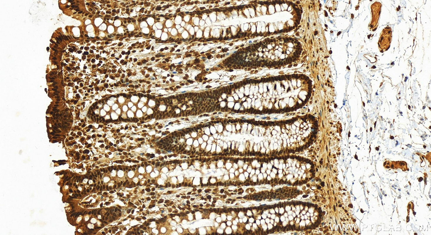 Immunohistochemistry (IHC) staining of human colon tissue using Transketolase Polyclonal antibody (11039-1-AP)