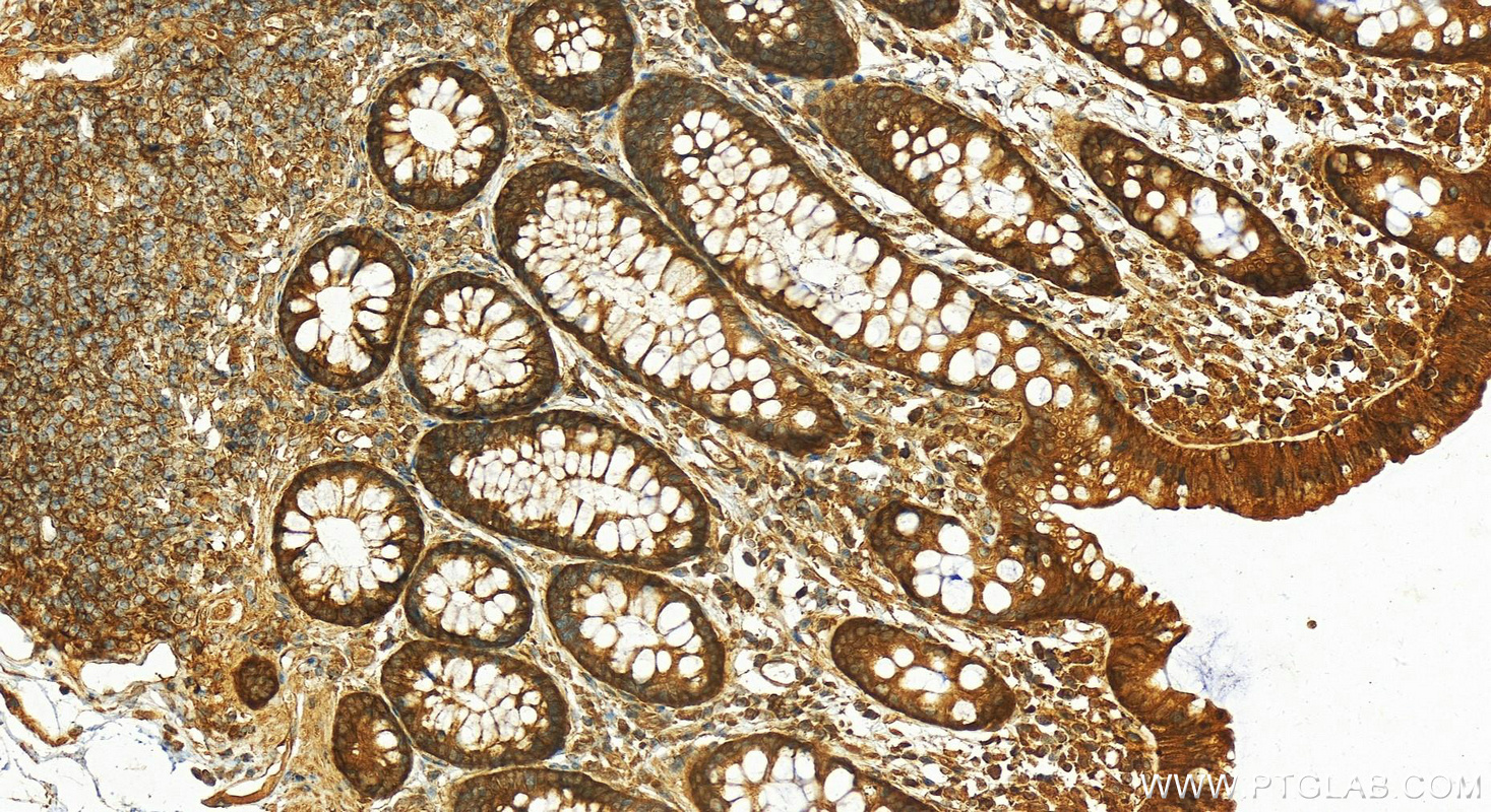 Transketolase