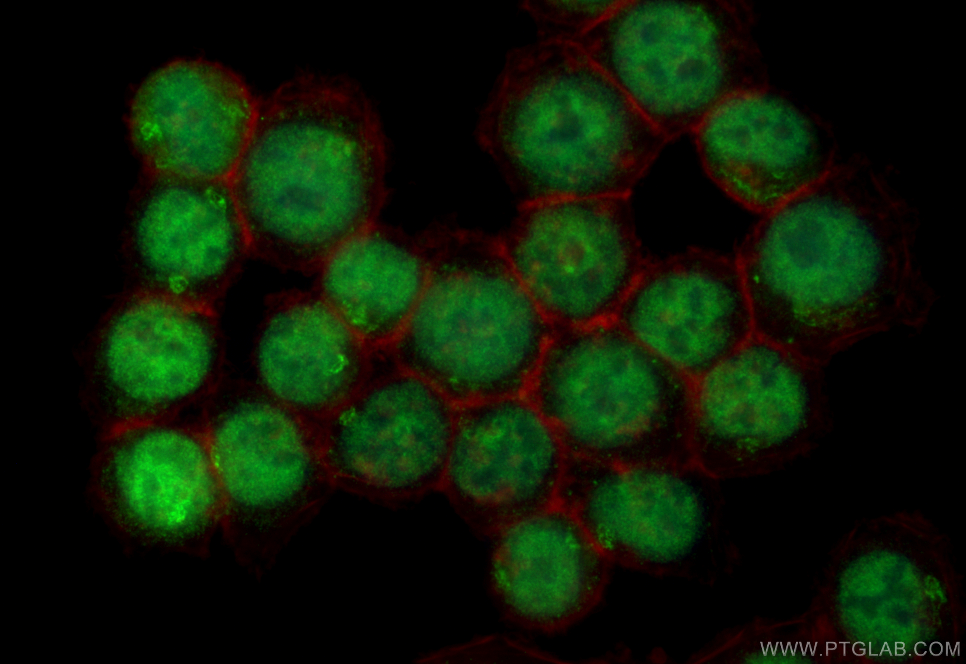 Immunofluorescence (IF) / fluorescent staining of BxPC-3 cells using Transketolase Polyclonal antibody (11039-1-AP)