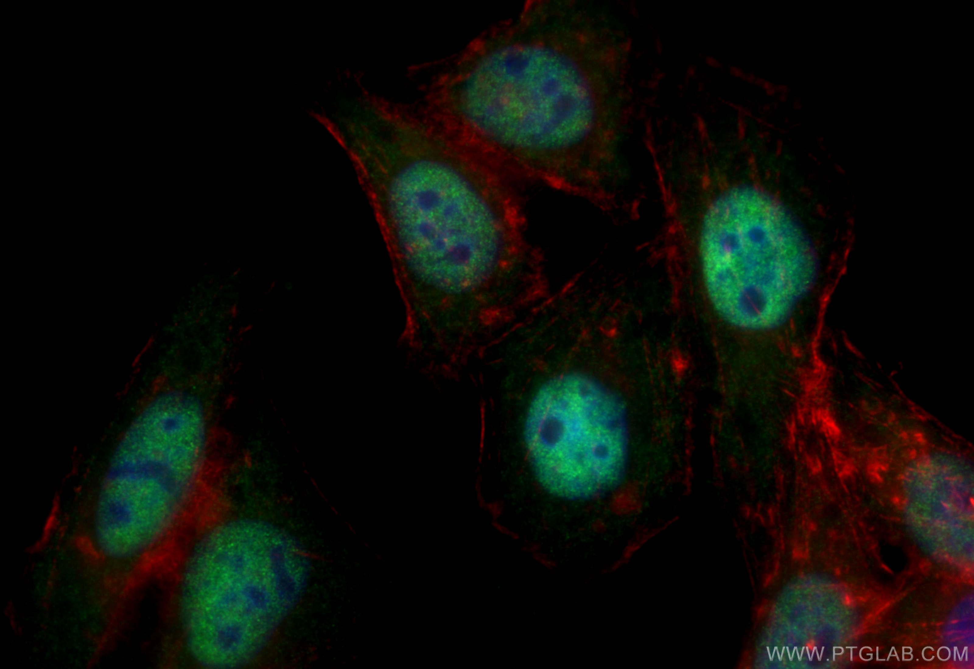 Immunofluorescence (IF) / fluorescent staining of HepG2 cells using Transketolase Monoclonal antibody (66016-1-Ig)