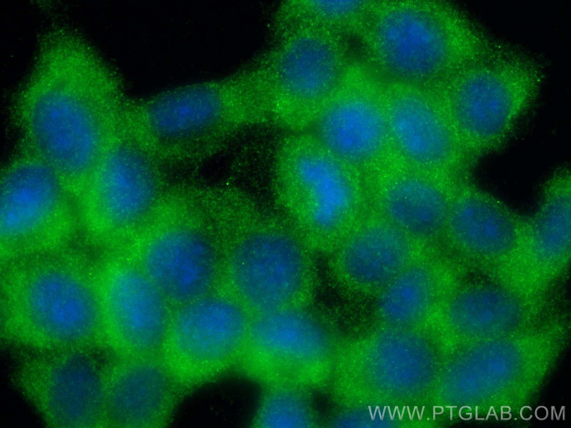 Immunofluorescence (IF) / fluorescent staining of HepG2 cells using TKTL2 Polyclonal antibody (17135-1-AP)