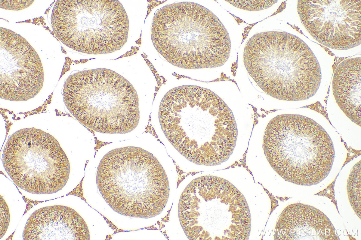 Immunohistochemistry (IHC) staining of rat testis tissue using TKTL2 Polyclonal antibody (17135-1-AP)