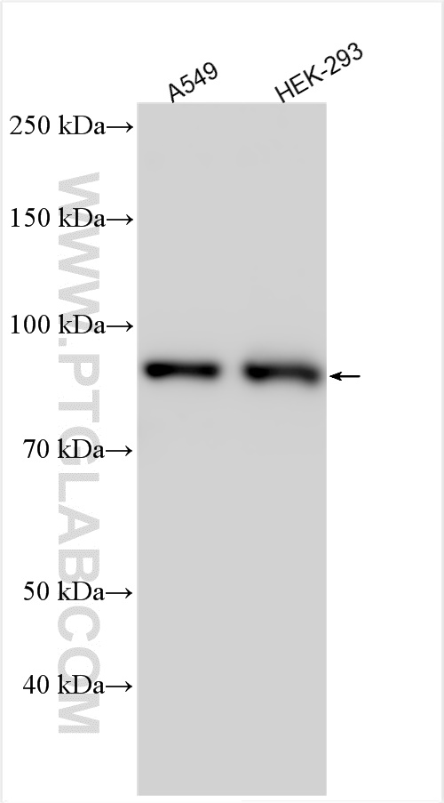 Western Blot (WB) analysis of various lysates using TLE1 Polyclonal antibody (22093-1-AP)