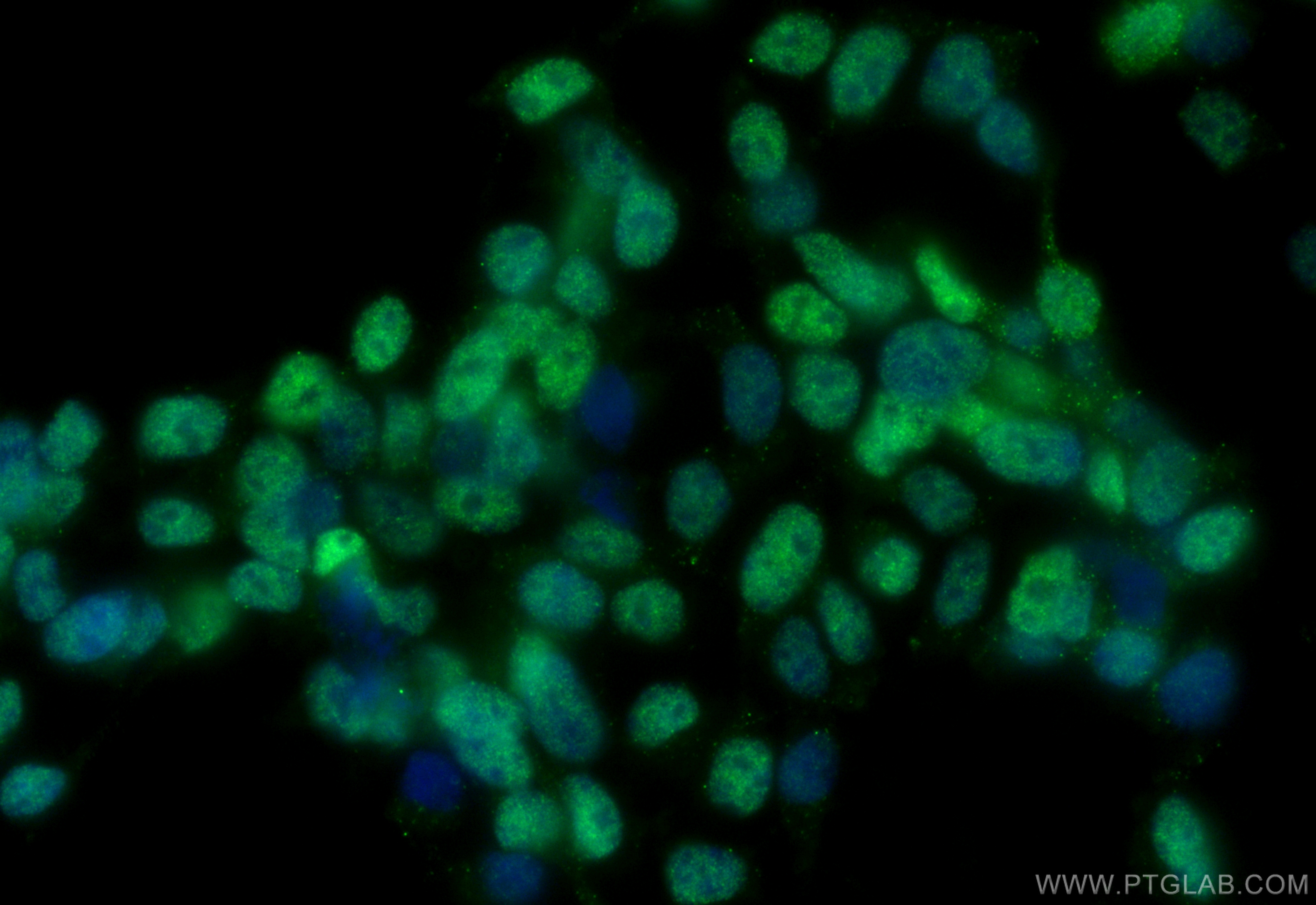 Immunofluorescence (IF) / fluorescent staining of SH-SY5Y cells using TLE1 Monoclonal antibody (66216-1-Ig)