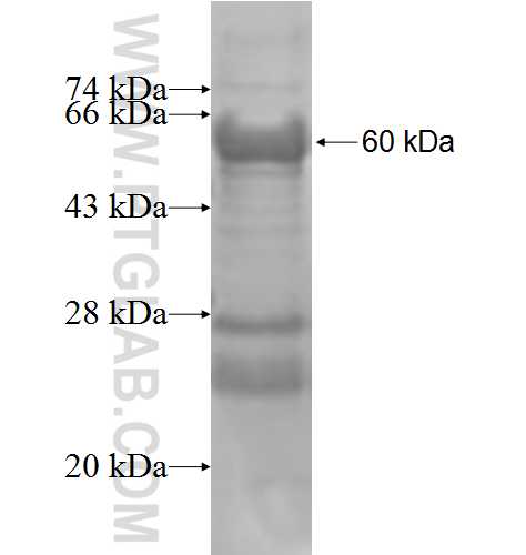 TLK1 fusion protein Ag4440 SDS-PAGE