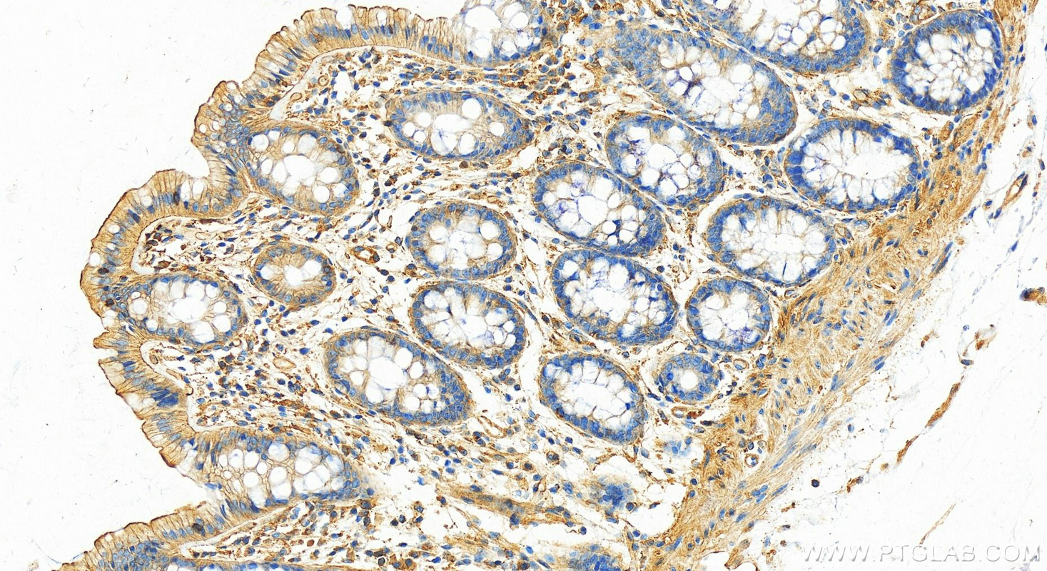 Immunohistochemistry (IHC) staining of human colon tissue using Talin-1 Polyclonal antibody (14168-1-AP)