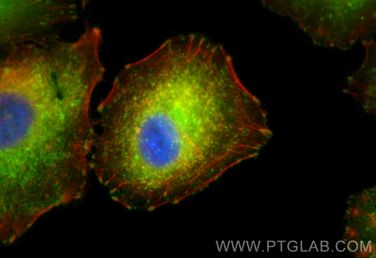 Immunofluorescence (IF) / fluorescent staining of A549 cells using Talin-1 Polyclonal antibody (14168-1-AP)