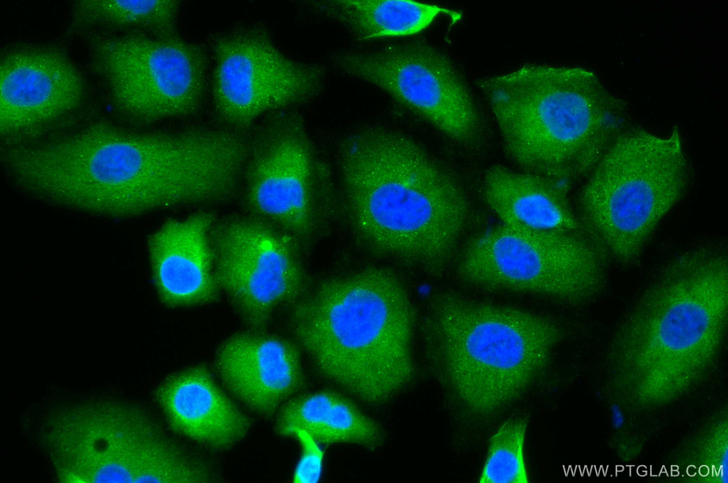 Immunofluorescence (IF) / fluorescent staining of A549 cells using Talin-1 Monoclonal antibody (67992-1-Ig)