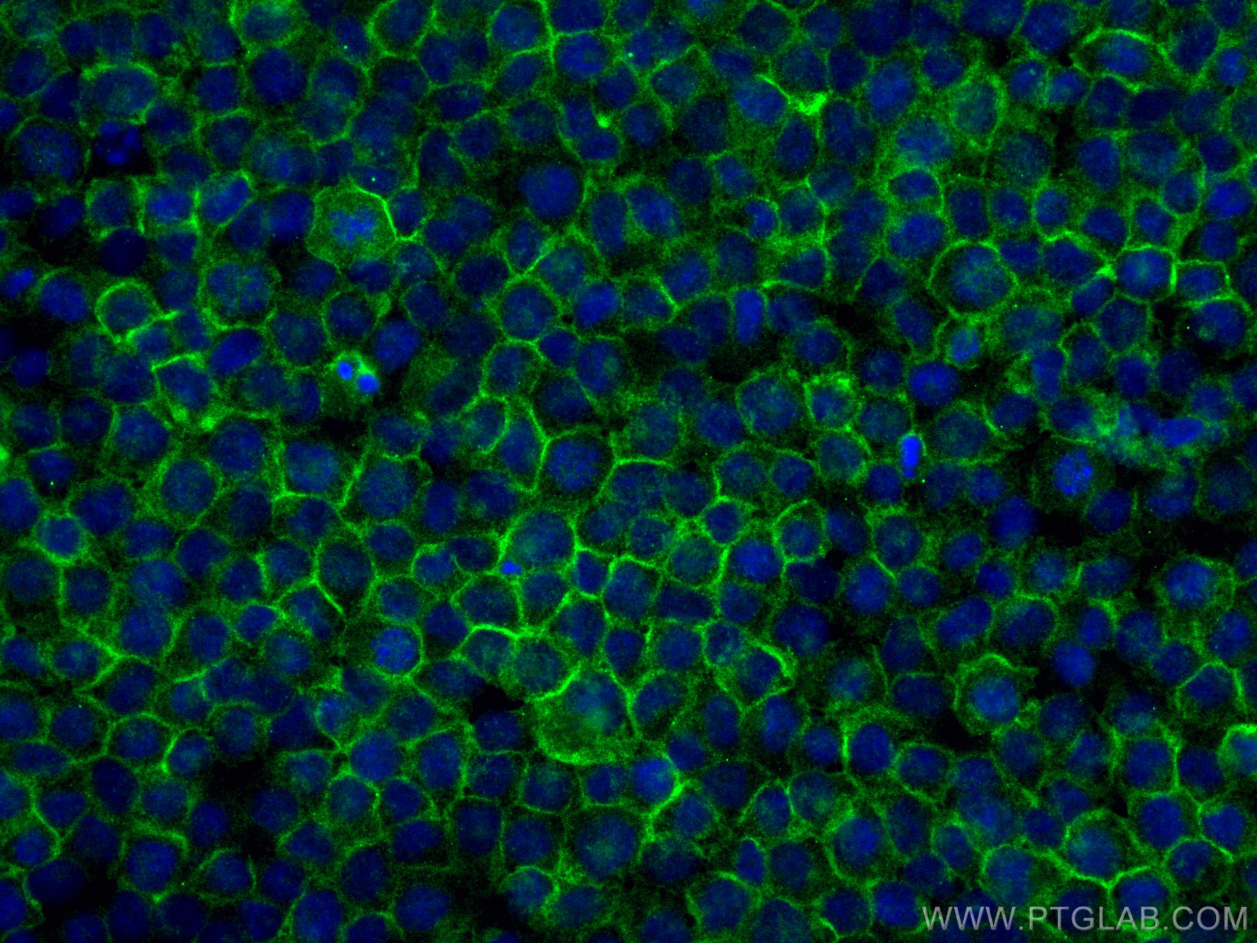Immunofluorescence (IF) / fluorescent staining of THP-1 cells using TLR2 Monoclonal antibody (66645-1-Ig)