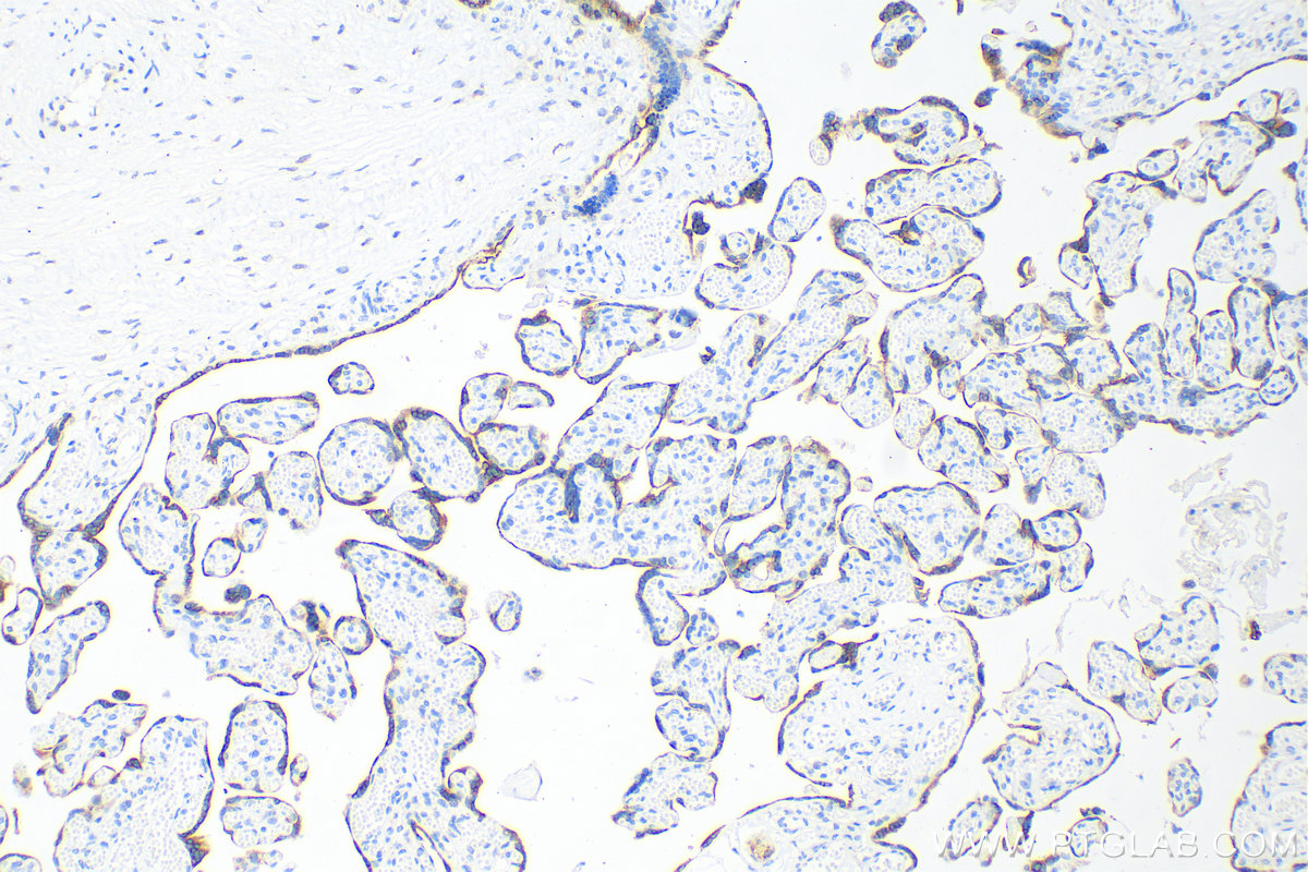 Immunohistochemistry (IHC) staining of human placenta tissue using TLR3 Recombinant antibody (83136-3-RR)