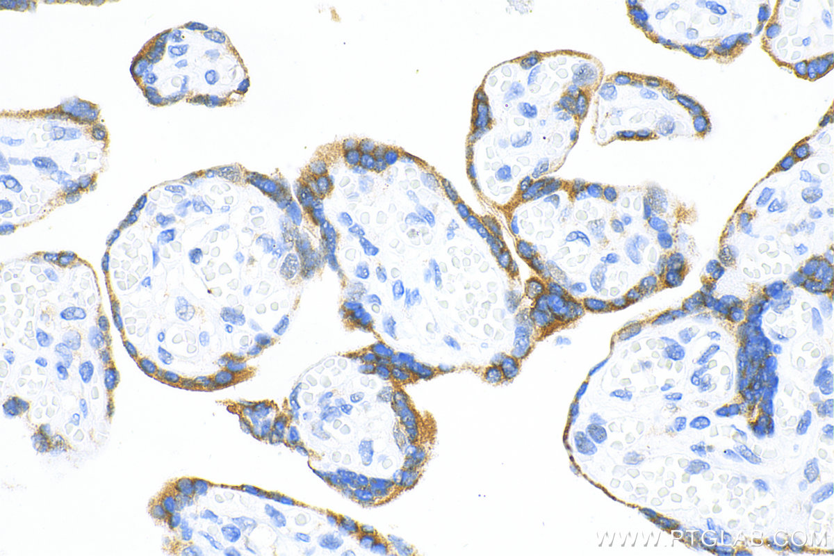 Immunohistochemistry (IHC) staining of human placenta tissue using TLR3 Recombinant antibody (83136-3-RR)