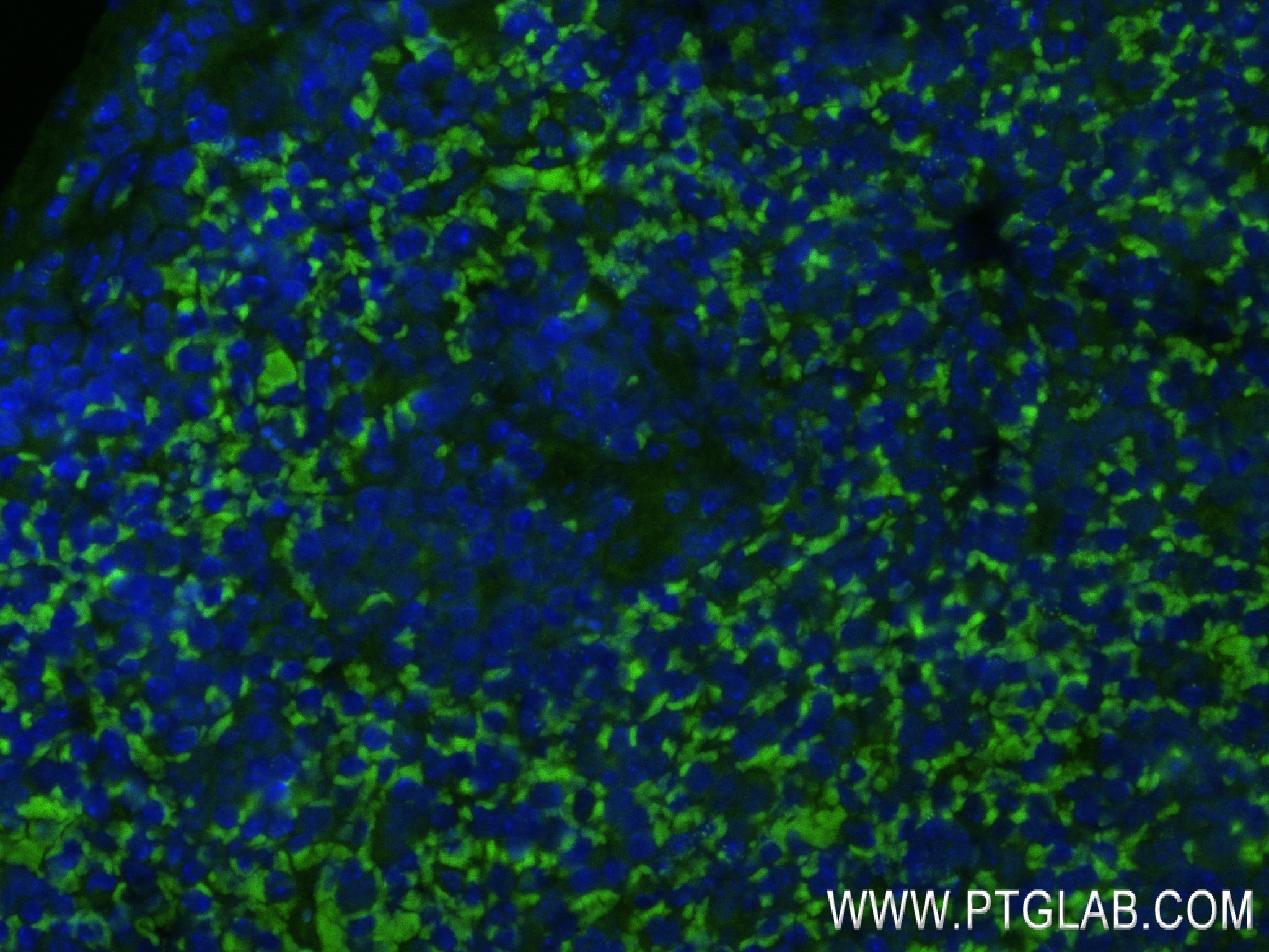 Immunofluorescence (IF) / fluorescent staining of mouse spleen tissue using TLR6 Recombinant antibody (84811-2-RR)