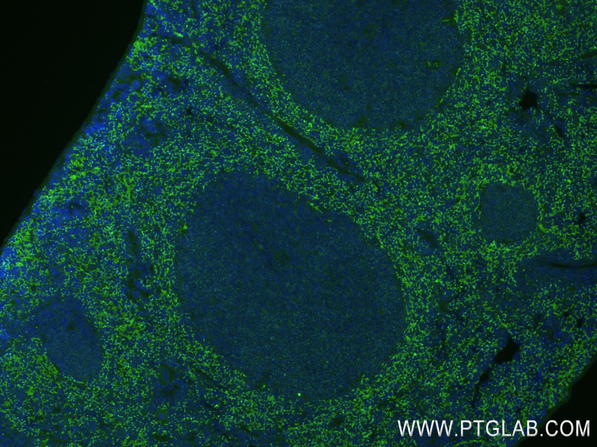 Immunofluorescence (IF) / fluorescent staining of mouse spleen tissue using TLR6 Recombinant antibody (84811-2-RR)