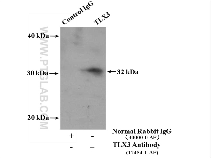 Immunoprecipitation (IP) experiment of Jurkat cells using TLX3 Polyclonal antibody (17454-1-AP)