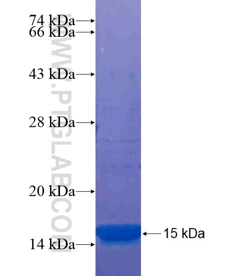 TM6SF1 fusion protein Ag21138 SDS-PAGE