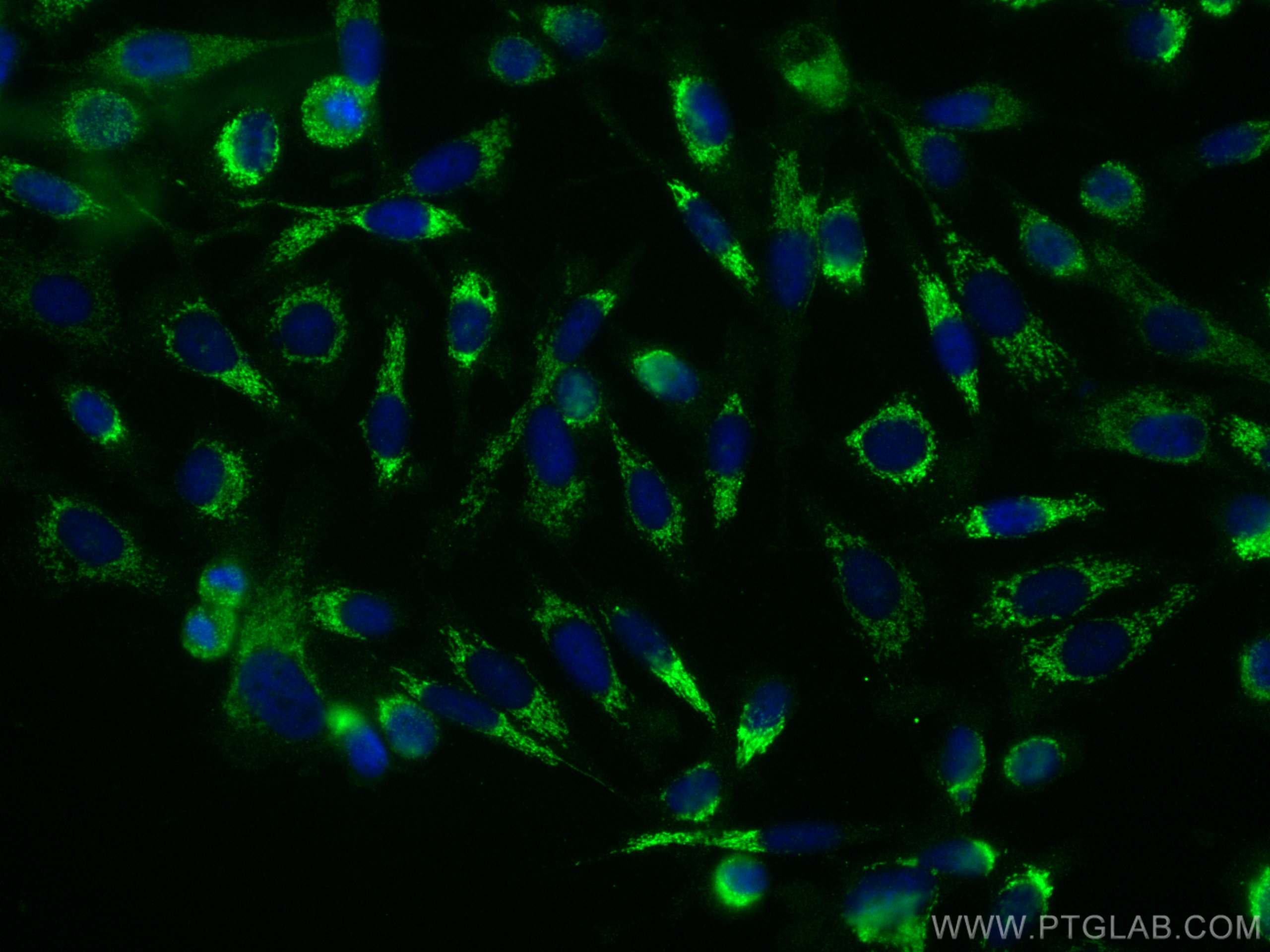 Immunofluorescence (IF) / fluorescent staining of PC-3 cells using TM7SF2 Polyclonal antibody (12033-1-AP)