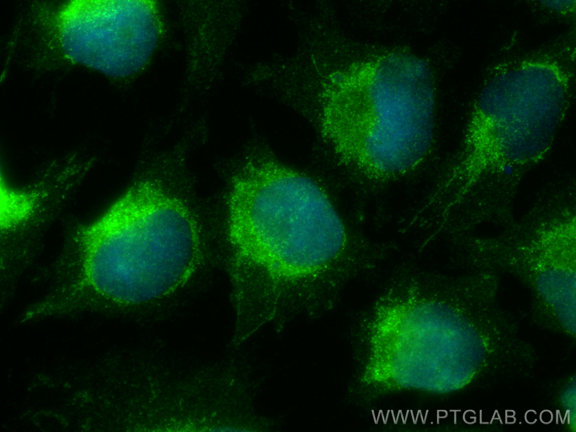 Immunofluorescence (IF) / fluorescent staining of U-251 cells using TM7SF3 Polyclonal antibody (19826-1-AP)