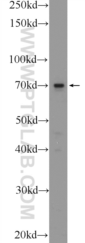 Western Blot (WB) analysis of A431 cells using TM9SF4 Polyclonal antibody (25595-1-AP)