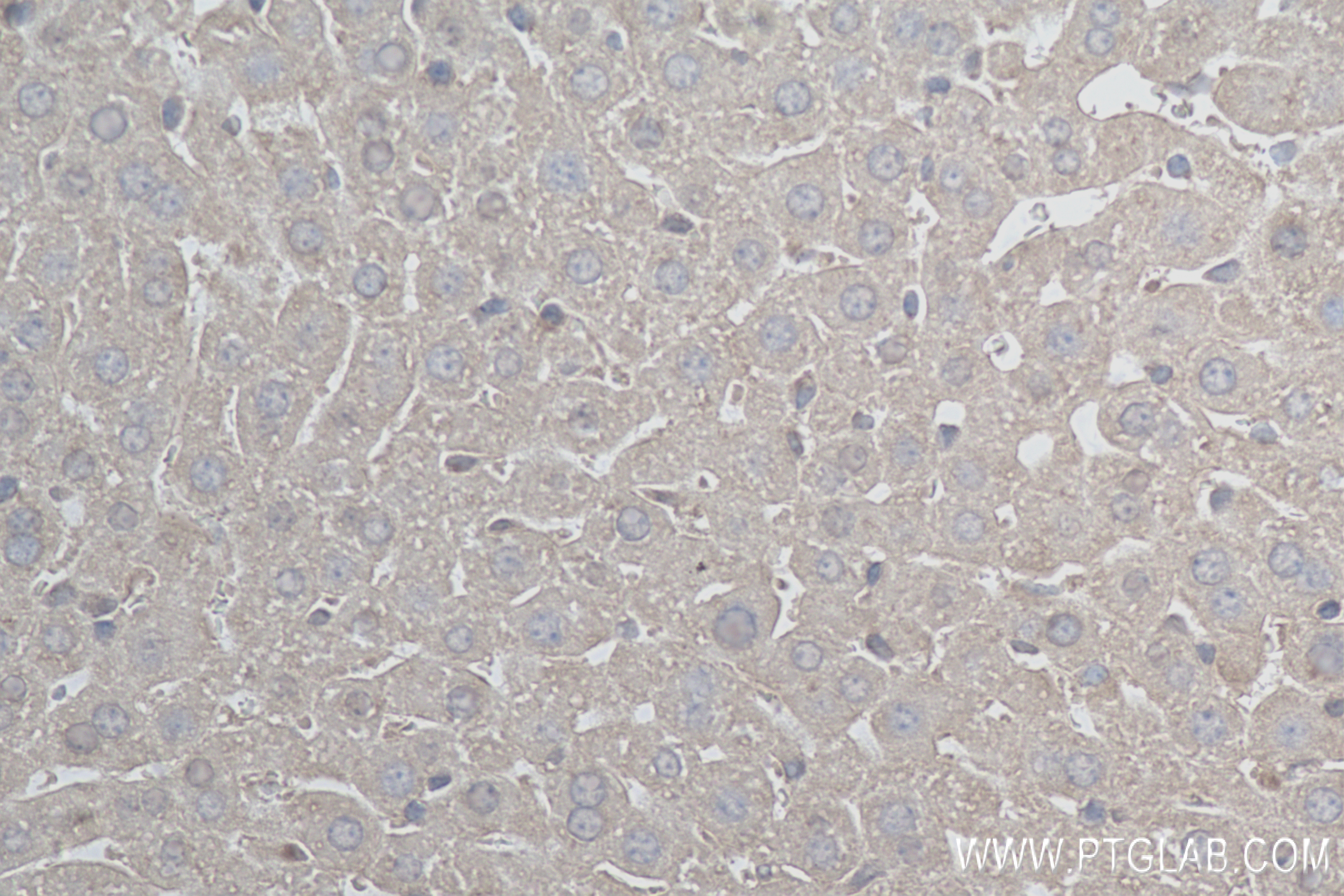 Immunohistochemistry (IHC) staining of mouse liver tissue using TMBIM6 Recombinant antibody (84499-1-RR)