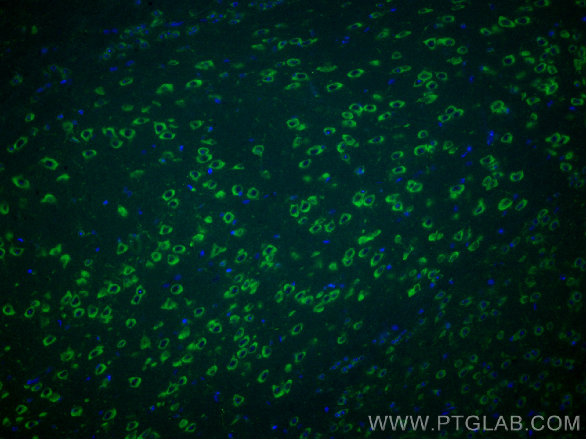 Immunofluorescence (IF) / fluorescent staining of mouse brain tissue using CoraLite® Plus 488-conjugated TMC1 Polyclonal anti (CL488-20718)