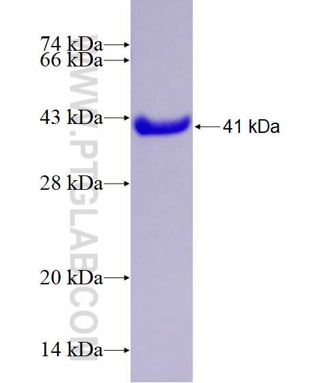 TMC4 fusion protein Ag28097 SDS-PAGE