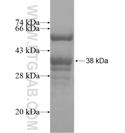 TMCC1 fusion protein Ag15367 SDS-PAGE