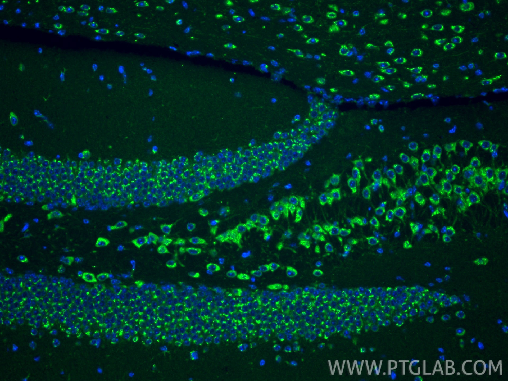 Immunofluorescence (IF) / fluorescent staining of mouse brain tissue using TMP21 Polyclonal antibody (15199-1-AP)